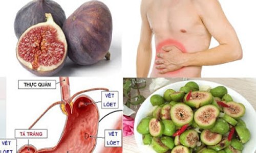 chua_dau_da_day_bang_qua_sung chua_dau_da_day_bang_qua_sung